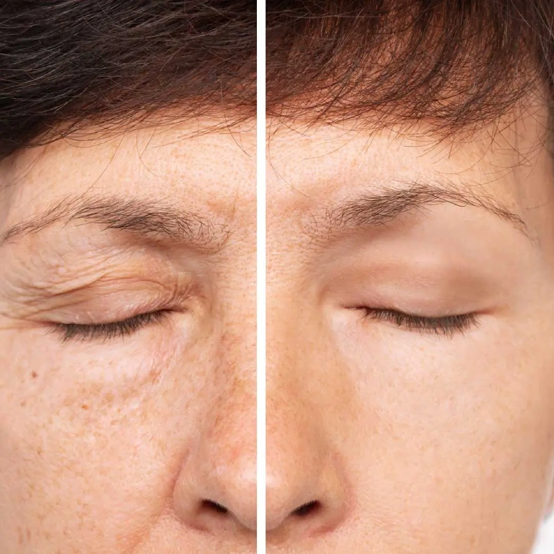 ARTE SECAO 04 BLEFA (1)